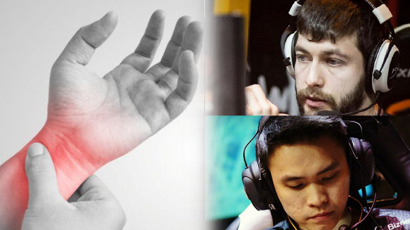 Carpal Tunnel Syndrome, Cedera yang Sering Dialami Pemain Esports